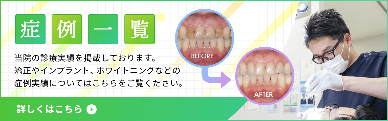 症例一覧 当院の診療実績を掲載しております。矯正やインプラント、ホワイトニングなどの症例実績についてはこちらをご覧ください。